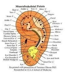 auriculoterapia como funciona