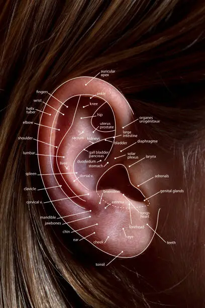 auriculoterapia que es?